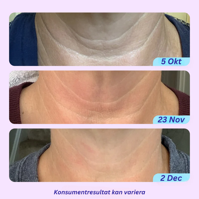 Neckure – Hals & Käklinje-kräm för fastare hud